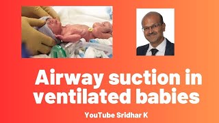 Suctioning in the ventilated neonate suction [upl. by Barbara947]