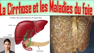 12 Symptômes Précoces de Cirrhose et de Maladies du Foie  Les Connaître Peut Sauver Votre Vie [upl. by Inge]