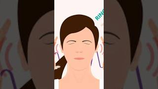 Tinnitus  Best Homeopathic Medicine shorts  drkirtivikram  Ringing in ear [upl. by Donald]