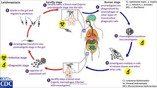 Leishmaniasis anthroponotic life cycle [upl. by Bever54]