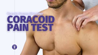 Coracoid Pain Test  Adhesive Capsulitis Diagnosis [upl. by Eenad]