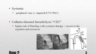 Thrombolytic therapy for pulmonary thromboembolism part 2 How [upl. by Hewie398]