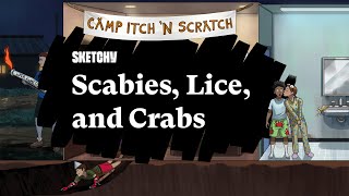 Scabies Lice amp Crabs A Study Guide Part 1  Sketchy Medical  USMLE Step 1 [upl. by Leinahtam]