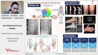 ESPONDILOARTROPATÍA SERONEGATIVA  REUMATOLOGÍA  VILLAMEDIC [upl. by Torbart824]