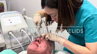 TIXEL  SKINCARE LASER CLINIC  POINT COOK MELBOURNE [upl. by Atoel412]