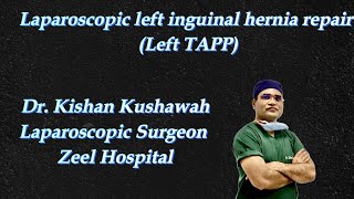 Laparoscopic left inguinal hernia repair with 3D mesh Left TAPP [upl. by Enneirda608]