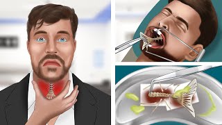 ASMR Animation Help MrBeast remove fish bones stuck in his throat [upl. by Esnahc]