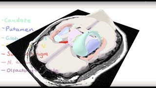 Basal Ganglia 3D Tour [upl. by Acessej]