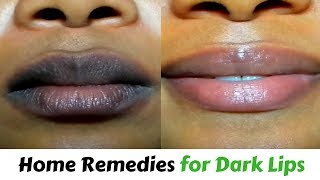 How To Get Rid Of Black Lips  Home Remedies For Dark Lips [upl. by Moneta]