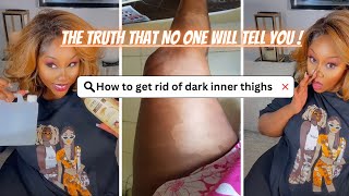 HOW TO LIGHTEN DARK INNER THIGHS IN JUST 3 Days  Clear Dark thigh Fast  DIY [upl. by Annahavas]