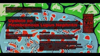 Update on Membranous Lupus Nephritis [upl. by Nevur]