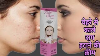 Skin alive cream kaisi haiSkin alive cream ko kaise use karenSkin alive cream for pigmentation [upl. by Senilec]