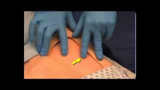 Anatomical Fascia Iliaca Compartment Block FICB Teaching Video [upl. by Meela429]