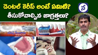 డెంటల్ కెరీస్ అంటే ఏమిటి తీసుకోవాల్సిన జాగ్రత్తలు  What are Dental Caries  Dental Tips [upl. by Ssenav113]