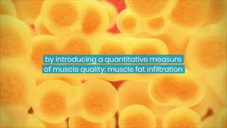 Improving sarcopenia assessment to identify individuals at risk of adverse outcomes [upl. by Eimyaj]