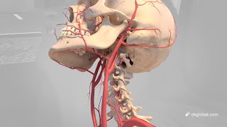 Cascading Pseudoaneurysms Plague Man After Minor Rear End Collision [upl. by Eduardo531]