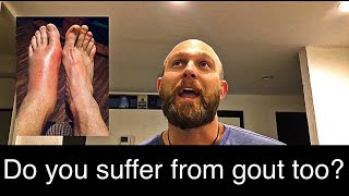 Gout Man Episode 1  How I First Found Out I Had Gout [upl. by Abe781]