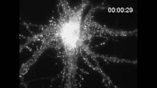 Neurons Brain Cells [upl. by Eylhsa]