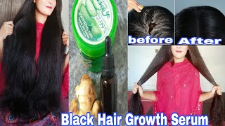 Extreme Hair Growth Use This Hair Growth Serum for Triple Hair Growth amp Density hairserum hair [upl. by Harshman]