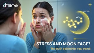 Can Stress Really Cause Moon Face Experts Explain the TikTok Trend [upl. by Ebsen]