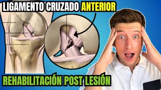 REHABILITACIÓN del Ligamento Cruzado Anterior LCA Sin CIRUGÍA con EJERCICIOS [upl. by Euqinemod]