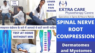 Nerve Root Compression Test for Lower Back without MRI नर्व रूट का कम्प्रेशन Lumbar Radiculopathy [upl. by Nicolais330]