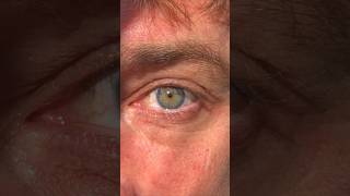 Rarest Human Eyes 👁️ central heterochromia [upl. by Ber]