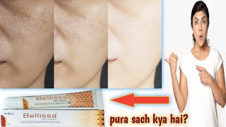 Bellissa lite cream review  benefits side effects  in hindi  Jaaniye pura sach [upl. by Leahcimal]