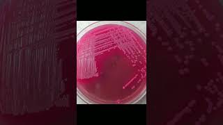 Growth of E Coli bacteria on various type of culture medi [upl. by Valma]