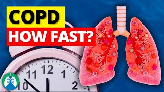 How Fast Does COPD Progress [upl. by Aidaas]