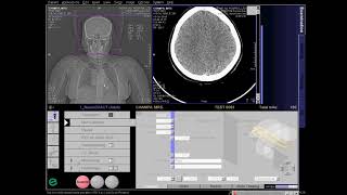 CT Cerebral Angio Full Work Process SIEMENS in syngo acquisition workplace [upl. by Lette]