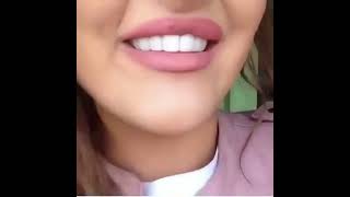 😁 OMG 😎 Its Awesome 😁 Instant Smile Teeth Veneers 2023 [upl. by Adanar]