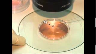 vitrification of embryos and oocytes [upl. by Landahl]