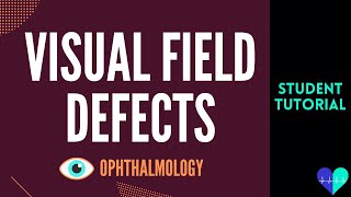 Visual Field Defects  Medical Tutorial [upl. by Muhammad]