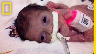 Born 4 Months Early This Tiny Survivor Beats the Odds  Short Film Showcase [upl. by Eelyahs]