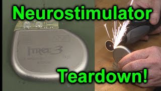 EEVblog 1027  Implantable NeuroStimulator Teardown [upl. by Aikemal721]