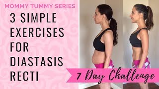 Get Rid Of Mommy Tummy with 3 Simple Diastasis Recti Exercises  7 Day Challenge [upl. by Yusem]