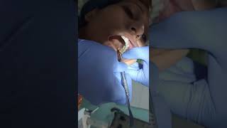 wisdom tooth removal at best dental clinic in patna by Dr Archana Rani and Dr Abhishek Kumar [upl. by Tremml309]