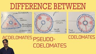 Acoelomates Pseudocoelomates and coelomates  Triploblastic organisation [upl. by Catarina]