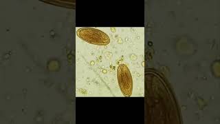 Parasitology  Identify [upl. by Norraf157]