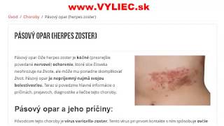 Pásový opar herpes zoster [upl. by Trust580]