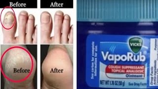 SHE APPLIES VICK VAPORUB ON HER FEET BEFORE BED WHEN YOU KNOW THE REASON YOU WILL DO THE SAME [upl. by Seraphine]