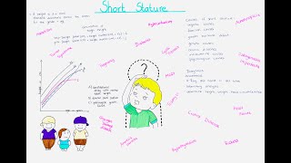 Short Stature in paediatric patients causes evaluation diagnosis treatment [upl. by Naujik]