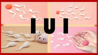 Intrauterine Insemination IUI  What is an IUI  How to get Pregnant with an IUI [upl. by Ellenyl]