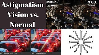 Astigmatism Vision vs normal Astigmatism Symptoms What is astigmatism [upl. by Reppiks226]