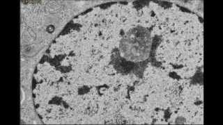 EUCHROMATIN and HETEROCHROMATINDNA [upl. by Nilyram]