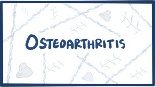 Osteoarthritis  causes symptoms diagnosis treatment amp pathology [upl. by Oiludbo269]