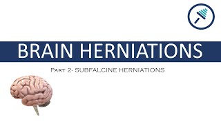 BRAIN HERNIATIONS 24 Subfalcine Herniations [upl. by Peedsaj]