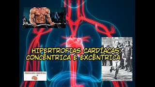 DIFERENÇAS ENTRE AS HIPERTROFIAS CARDÍACAS CONCÊNTRICA E EXCÊNTRICA [upl. by Vanessa]