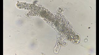 Amoeba movement with pseudopodia under a microscope [upl. by Melany]